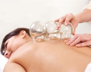 cupping practices during physical therapy treatments
