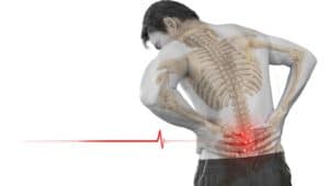 physiotherapy for back pain Miami FL