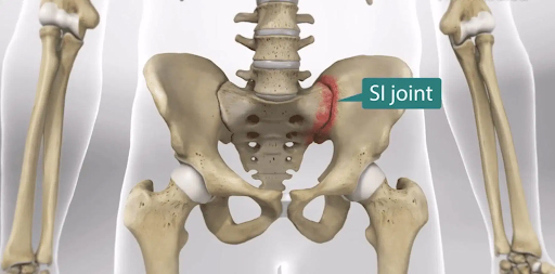 Low back pain SI joint symmetry pt miami