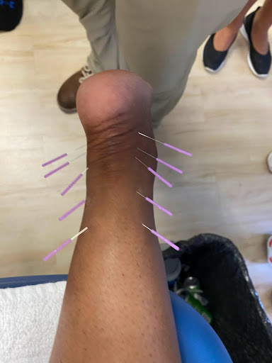 Ankle symmetry physical therapy miami
