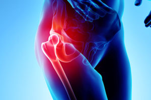 Physical therapy for hip pain symmetry pt miami