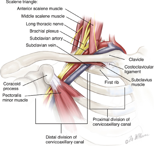 What is First Rib Syndrome?