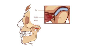 Jaw Diagram