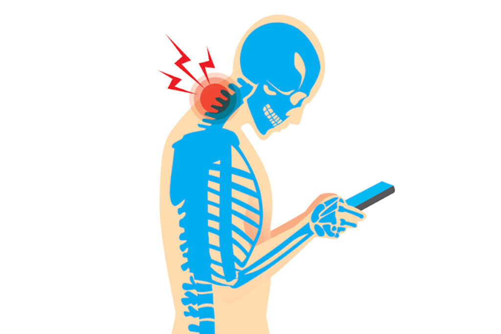 “TECH NECK” - 5 Exercises to Help Combat Chronic Neck Pain