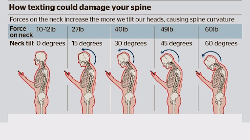 Spinal Damange from Texting