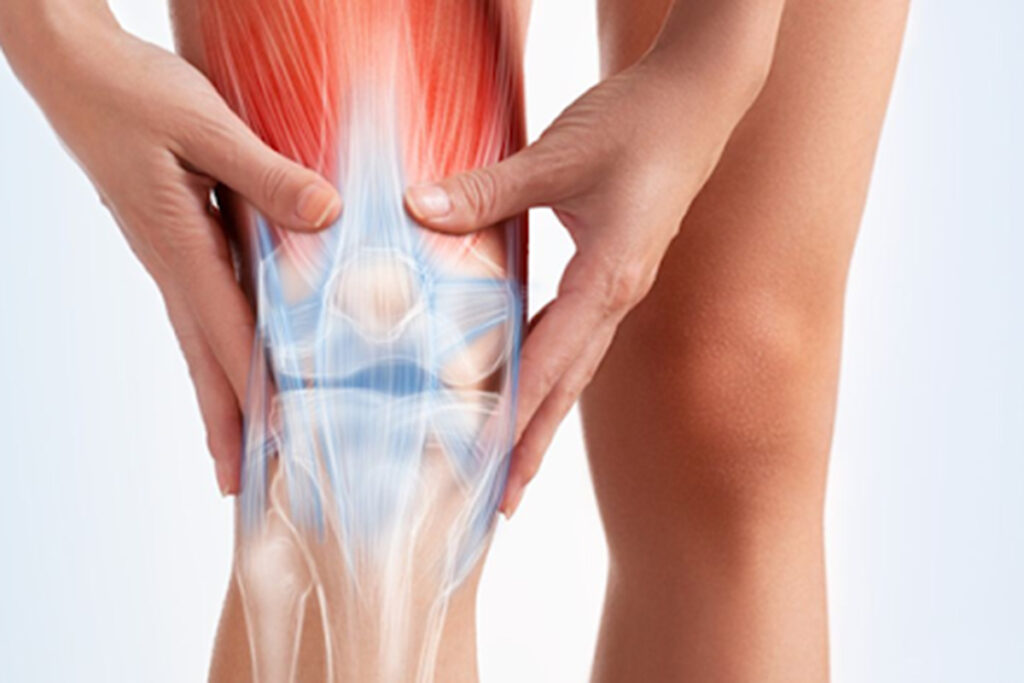 What is Quadriceps Tendonitis?