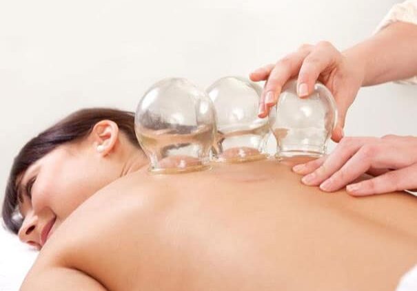 cupping practices during physical therapy treatments