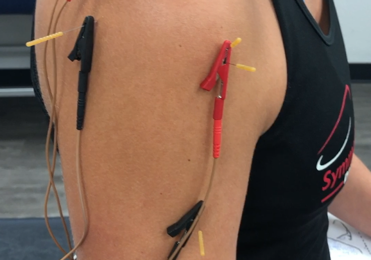 dry needling shoulder